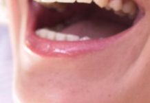 Service with a smile