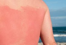 Love the skin you’re in