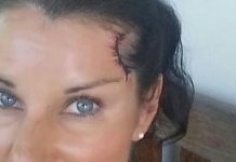 Spotlight on melanoma