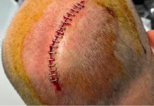 Surf chaos hits headlines