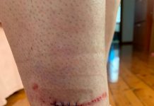 Meter readers sharpen their focus on safe entry