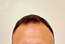 Rediscover your smile with Dr Felipe