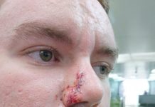 Australia Post reveals QLD as the worst state for dog attacks on Posties