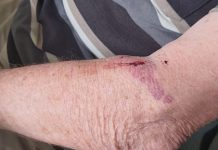 Noosa man, 84, knocked over and injured by e-scooter